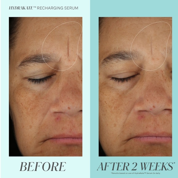 💦 Kate Somerville HydraKate Recharging Serum - Picture 5 of 11